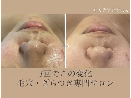 エヌ(enu)の写真