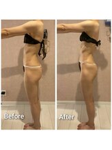 エミア(Emia)/全身痩せ×歪み改善◎120分 １回