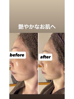 ジュネラ ボーテ(Jenela beaute)/ツヤハリ変化