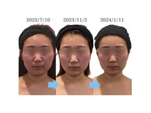 小顔フェイスラボ 栄店(小顔Face Labo.)の雰囲気（エラ張り/むくみ/歪み/大きさ/輪郭の形など何でもお任せ下さい♪）