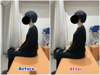 最後の整体 南郷18丁目駅院/首の痛みでお悩みの方の姿勢変化