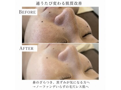ココフルール(Cocofleur)の写真
