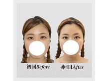 ウニカ(Unica)の雰囲気（目の開きの変化◎デスクワークによる眼精疲労/スマホ疲れ）