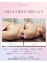 ソルナティ 伊勢原(SOLNATY)/ボリューム・左右差のお悩みに◎