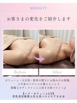 ソルナティ 伊勢原(SOLNATY)/ボリューム・左右差のお悩みに◎