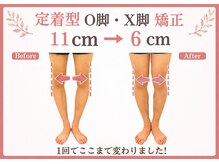 整体院がく 前橋駒形院