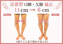 整体院がく 前橋駒形院