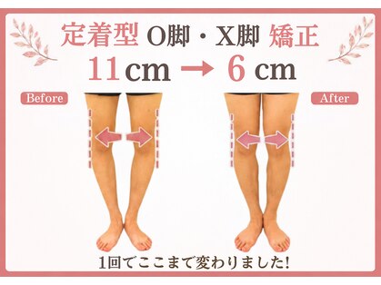 整体院がく 前橋駒形院の写真