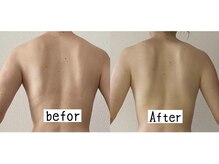 新百合ケ丘の痩身専門エステサロン リリバ(ririva)/深層筋膜リリース1回での効果