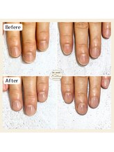 カロッス(Kallos)/自爪育成