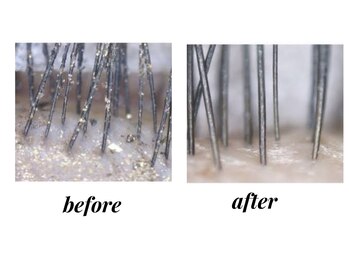 ネオビューティー(Neo beauty)/オプションメニューおすすめ♪