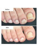 ネイルアトリエ ボン(nail atelier bon)/フットネイルケア