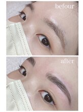 エム ネイル アンド アイ(M NAIL and EYE)/ビフォーアフター