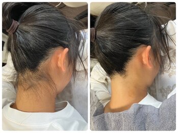 アプロディタ/キッズにも大人気！うなじ脱毛♪