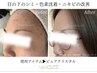 《無料カウンセリング》スキンケアで肌質改善したい方