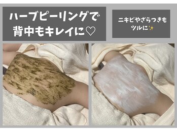 リグレア 浦安(Re.GLARE)/背中ケア