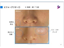 サロン チコルル(salon chikolulu)/