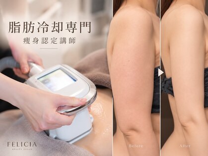 フェリシア(FELICIA)の写真