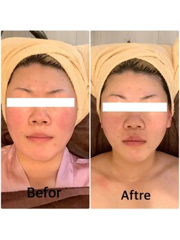 スペチアーレ 夙川/小顔と美肌が手に入る