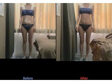 ビタミンスパ 中野店/施術回数★1回目