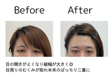 オリナ(olina)/-before & after-