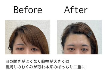 オリナ(olina)/-before & after-