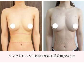 エイミー(Aimee)/彼にバレちゃうふんわりバストに