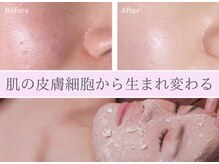 マリヴェリーテ(Mari verite)の雰囲気(丁寧なカウンセリング。お悩み、症状をお聞かせください。)