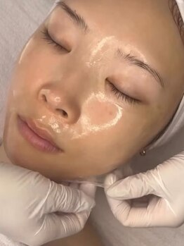 irisの写真/毛穴落ち&くすみ卒業!韓国式ピーリング×エステ版ダーマの相乗効果で、内側から弾むような水光肌を実感♪