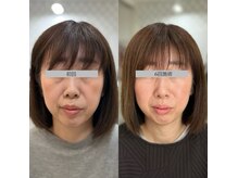 ダリア(Dahlia)の雰囲気（人気施術【30代・40代編】高周波たるみケア♪オニキス★）