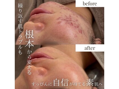 サロンドシェフィア(Salon de Chefia)の写真