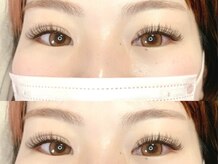 エレヴィ(elevi)/バインドロック