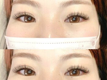 エレヴィ(elevi)/バインドロック