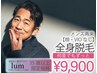 【35歳以上】メンズ脱毛　全身脱毛（顔・VIOなし）¥9,900