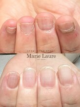 マリーロール 淀屋橋本店(Marie Laure)/自爪育成/深爪矯正/ネイルケア