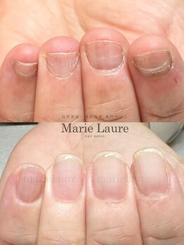 マリーロール 淀屋橋本店(Marie Laure)/自爪育成/深爪矯正/ネイルケア
