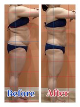 ハンズ鍼灸接骨院小牧院 美容整体ハンズ(美容整体hands)/エステ 痩身