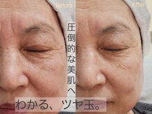シファ(Sifa.)/ホワイトスノーピール