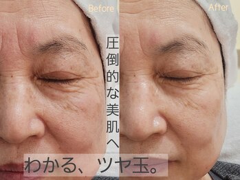 シファ(Sifa.)/ホワイトスノーピール