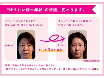 理想の小顔 福島店/質の高いトータルケアの施術