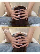 タワワ(TaWaWa)/30代女性　小顔矯正　初回