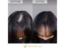 アボット キニー(Abbot Kinney)/