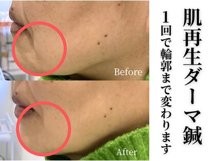 ココハリの写真