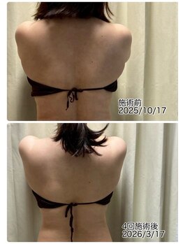 クールスパ(COOL SPA)/【100カップチャレンジ経過】