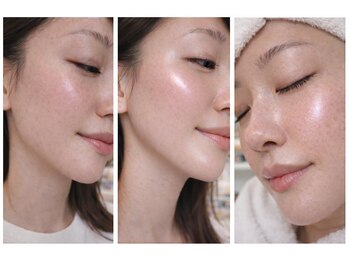 メルト 中目黒(Melt.)の写真/なんとなく続けるケアから卒業。状態を見極め、構造から整える本質的な肌改善サロン専門サロン◇