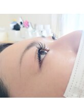 ルネッタ(LUNETTA)/150本コース