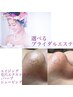【ブライダル限定】回数自由★シェービング前に★毛穴ケア+ハーブピーリング