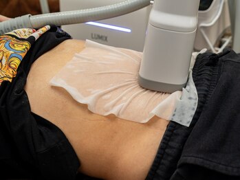 縁(en)の写真/上半身ダイエットに最適!!話題の最新脂肪冷却マシン☆何をしても痩せないお悩み箇所にも効果抜群♪