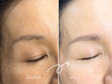 レディゴー(LADY GO)/ベースも透明感♪美眉♪