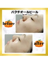 グランディールアン(GRANDIR UN)/艶美肌